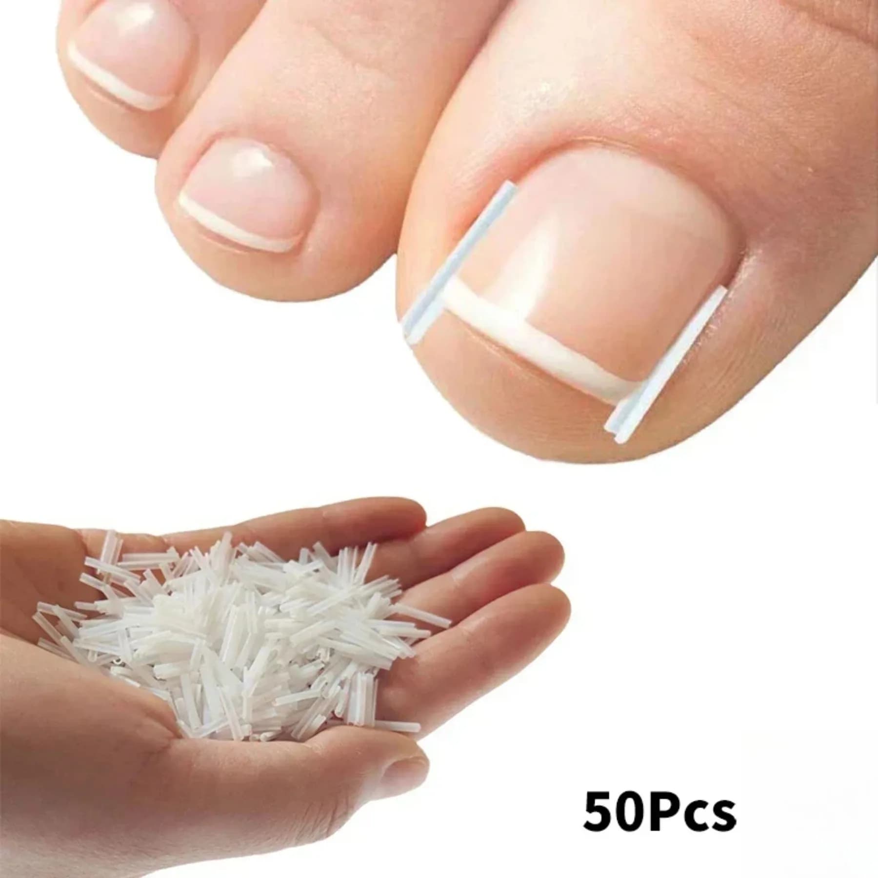 set of 50 elastic ingrown toenail clips — image 2