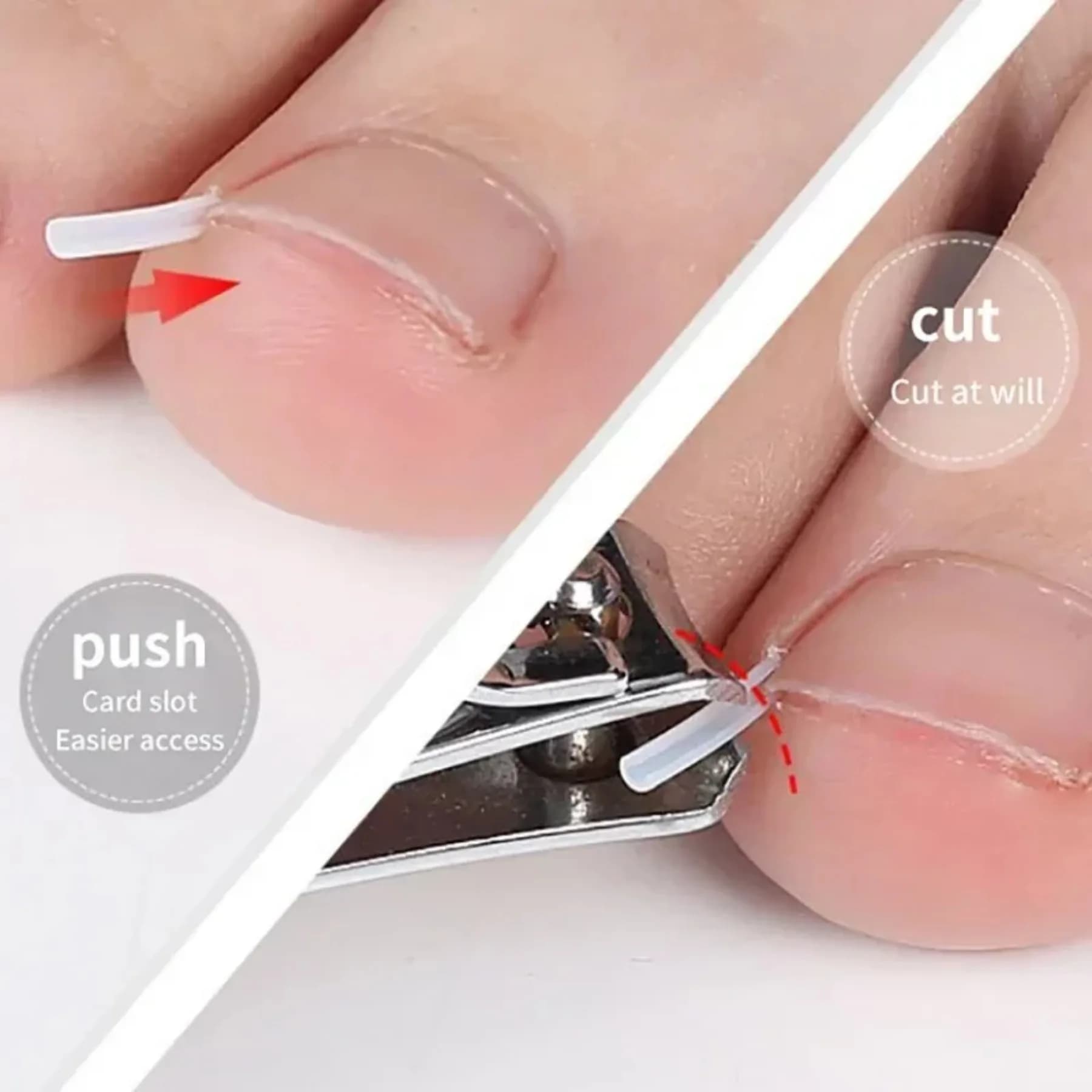set of 50 elastic ingrown toenail clips — image 5