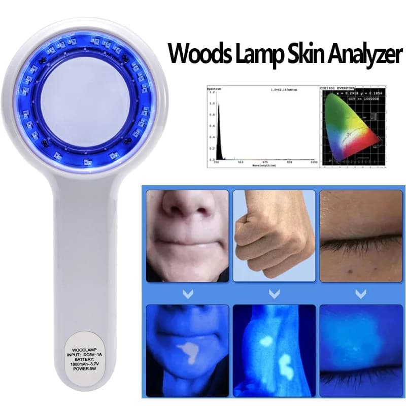 Portable Wood's Lamp Skin Analyzer