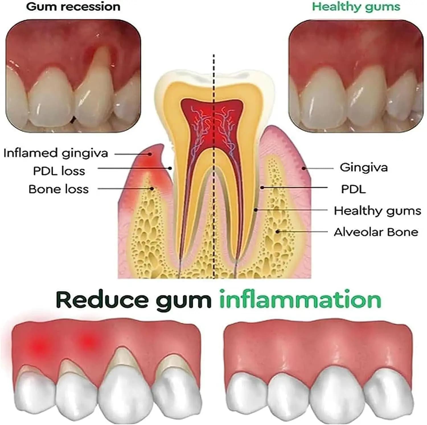 Bottle of gum recession relief serum — image 3