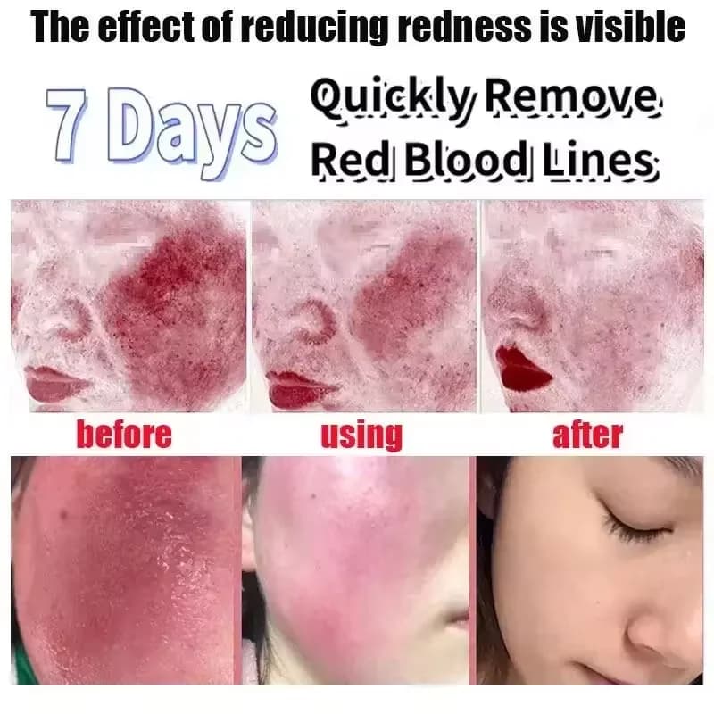 Jar of redness relief facial cream — image 4