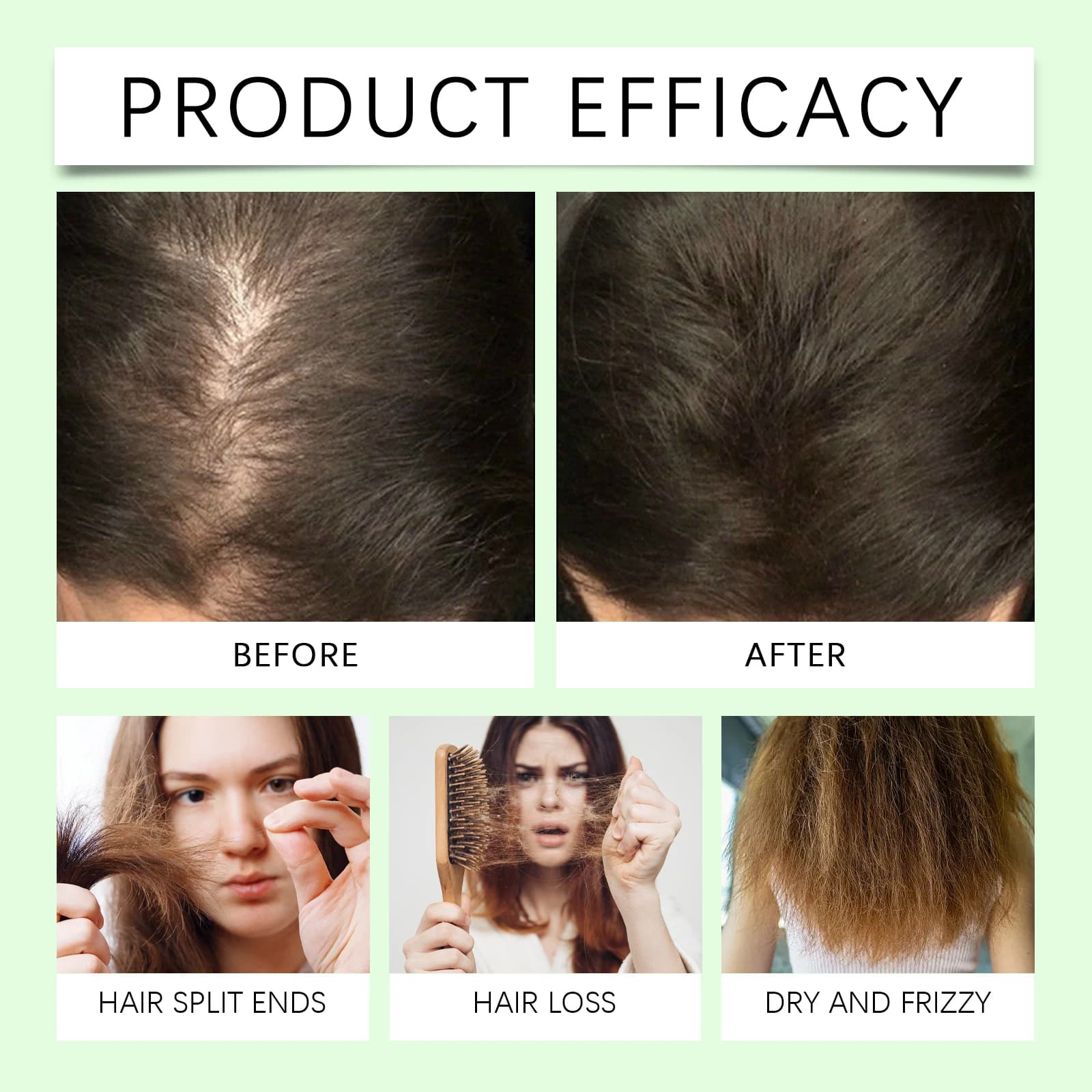Rosemary shampoo bottle for soothing scalp and anti-dandruff — image 3