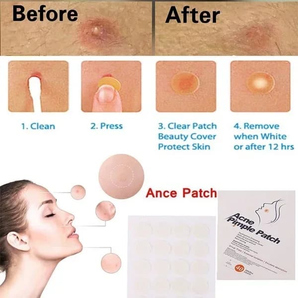 pack of 24 acne spot treatment patches — image 3