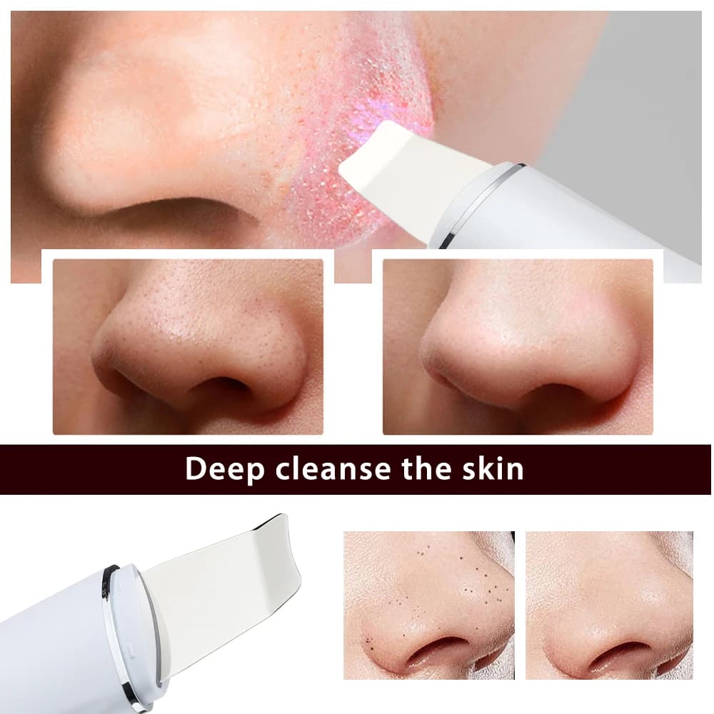 Handheld ultrasonic skin scrubber device — image 6