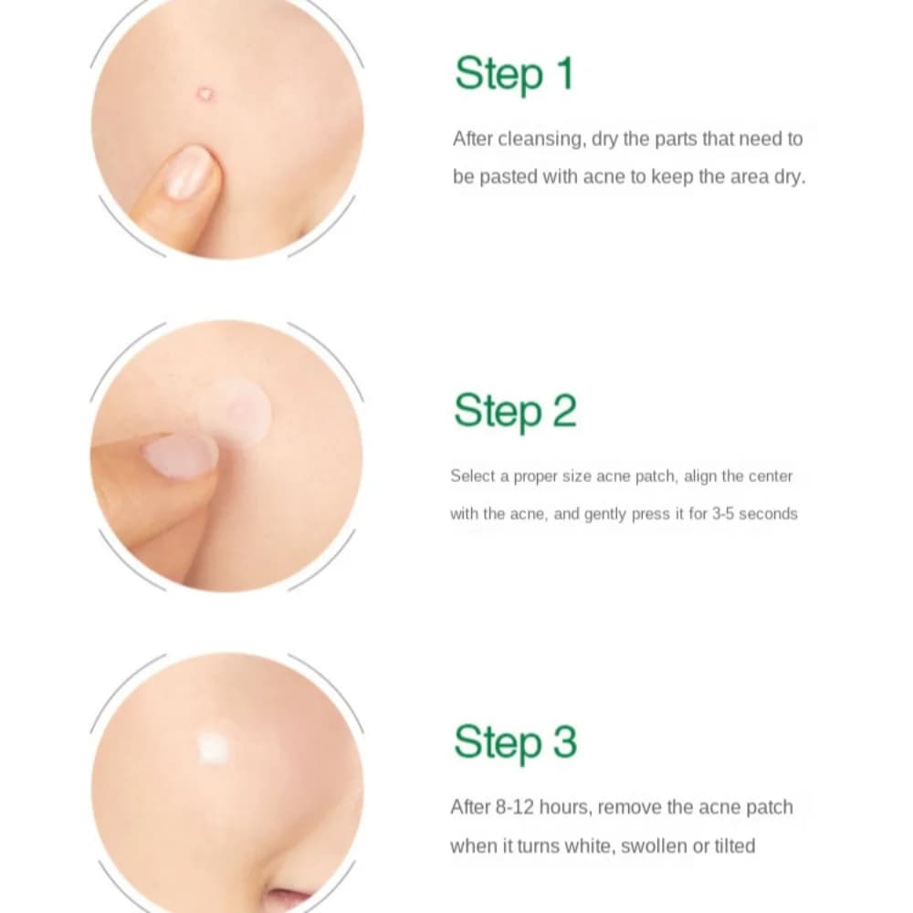 transparent acne pimple patch — image 6