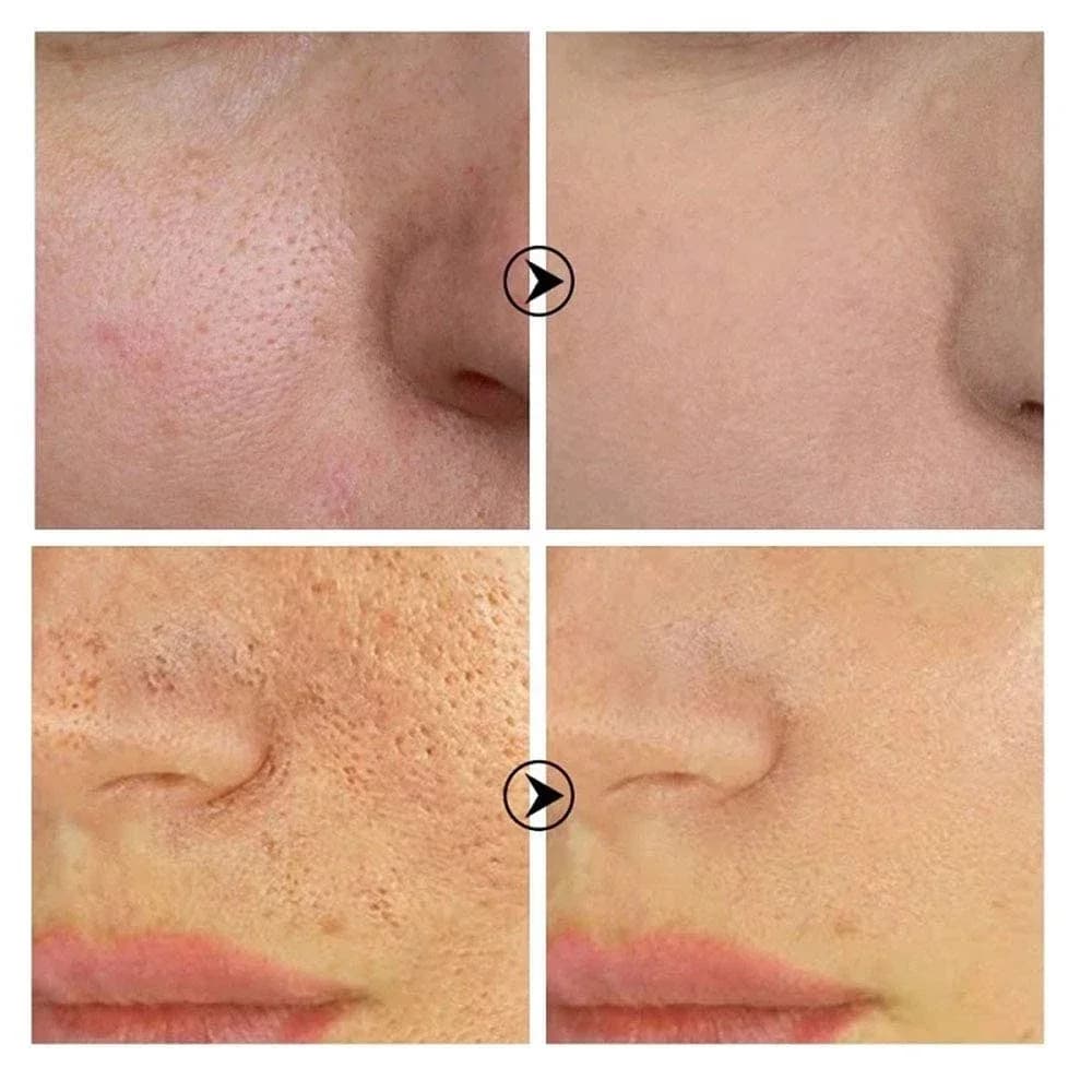 Retinol and niacinamide brightening serum bottle — image 6