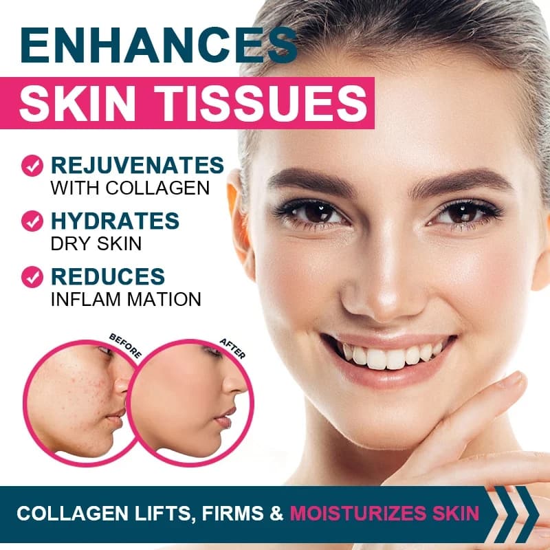 bottle of multi-collagen supplement — image 5