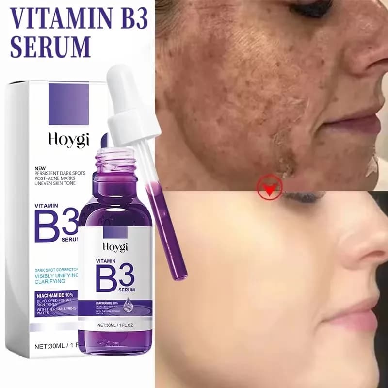 Vitamin B3 Serum for Dark Spot Lightening