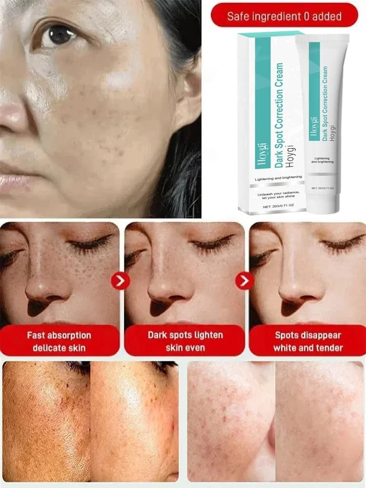 spot removing brightening cream jar — image 3