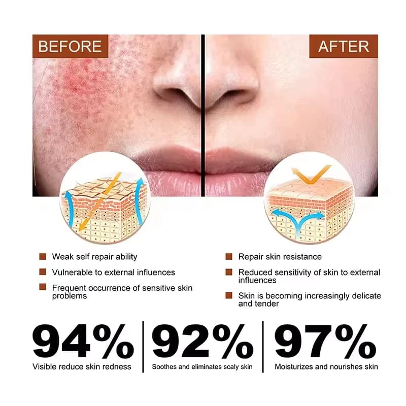 Jar of redness relief facial cream — image 5