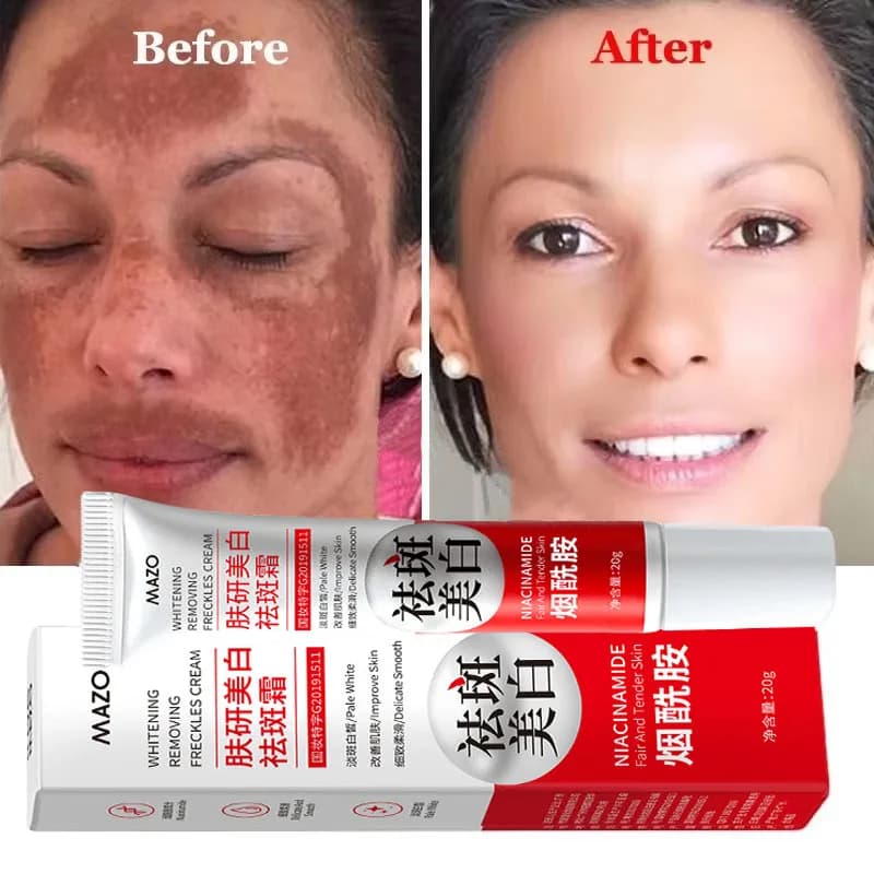 spot-removing brightening cream tube — image 2