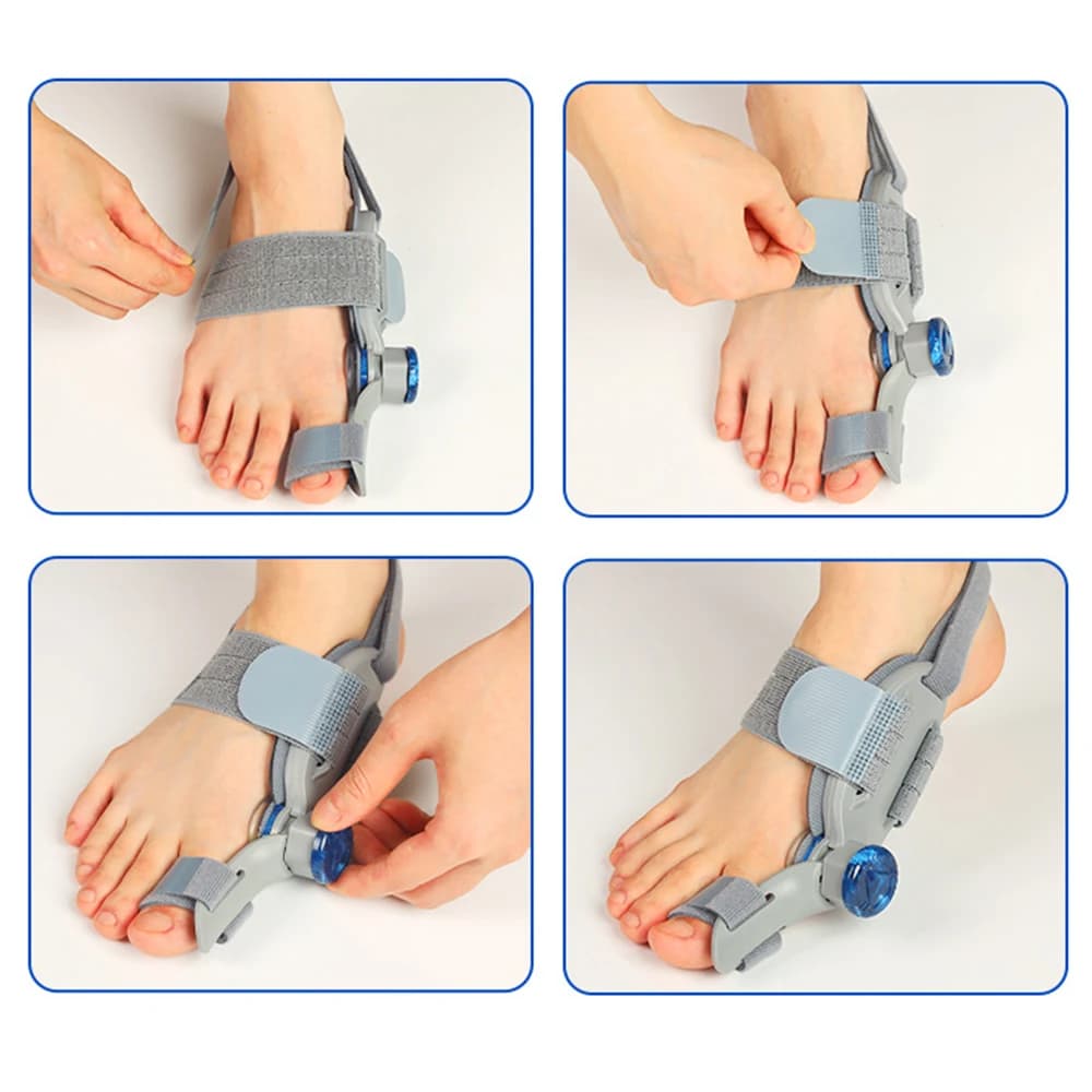 bunion splint for hallux valgus correction — image 5
