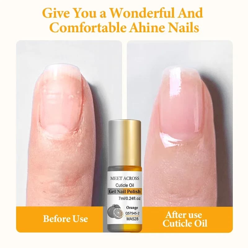 7 ml bottle of nail nutrition oil with six scent options — image 3