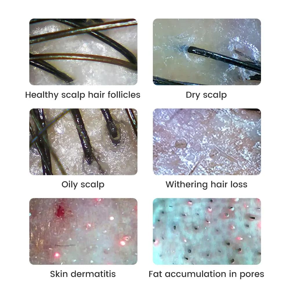 handheld wireless dermatoscope for scalp and skin analysis — image 5