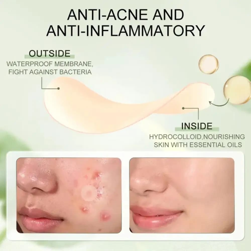 hydrocolloid acne patches with salicylic acid and tea tree oil — image 3