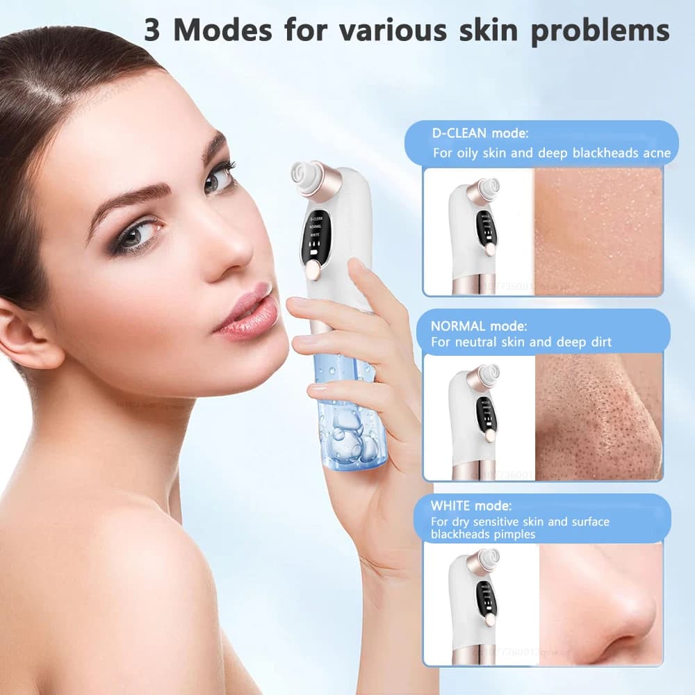electric pore vacuum blackhead remover — image 6