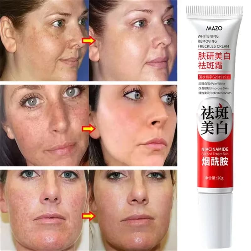 spot-removing brightening cream tube — image 3