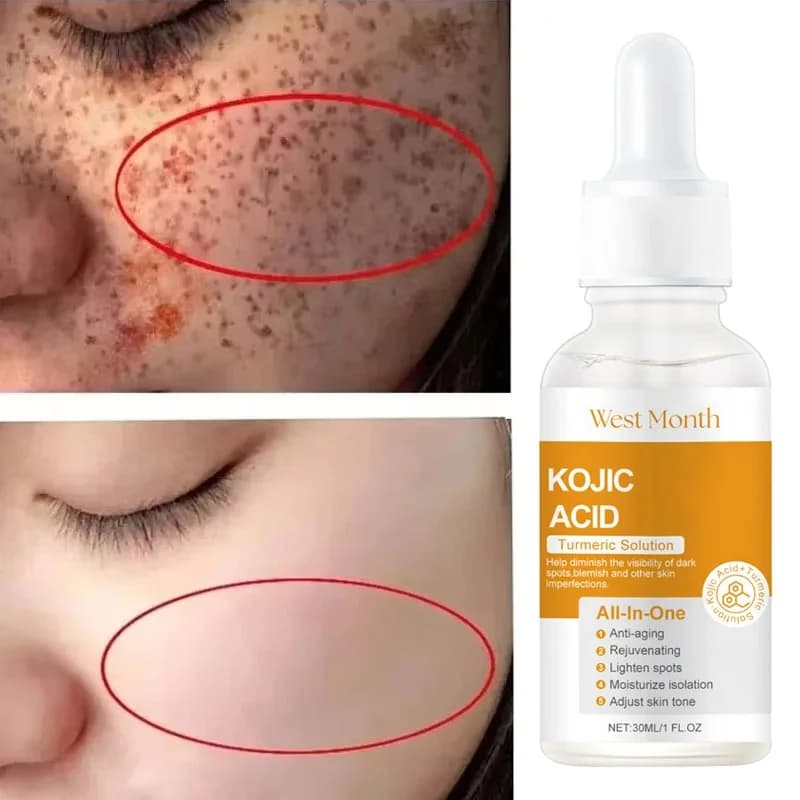 Kojic acid whitening essence bottle — image 1