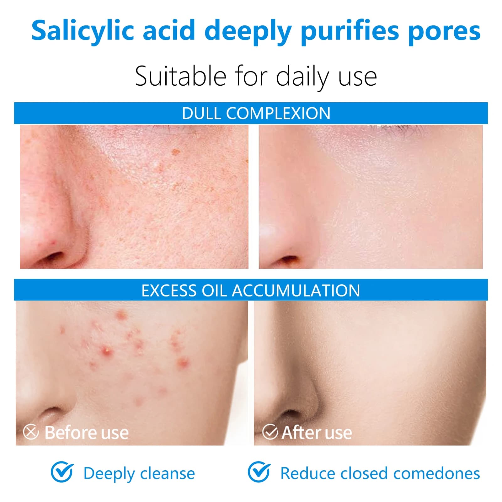 dual-action facial toner pads with AHA and BHA — image 6