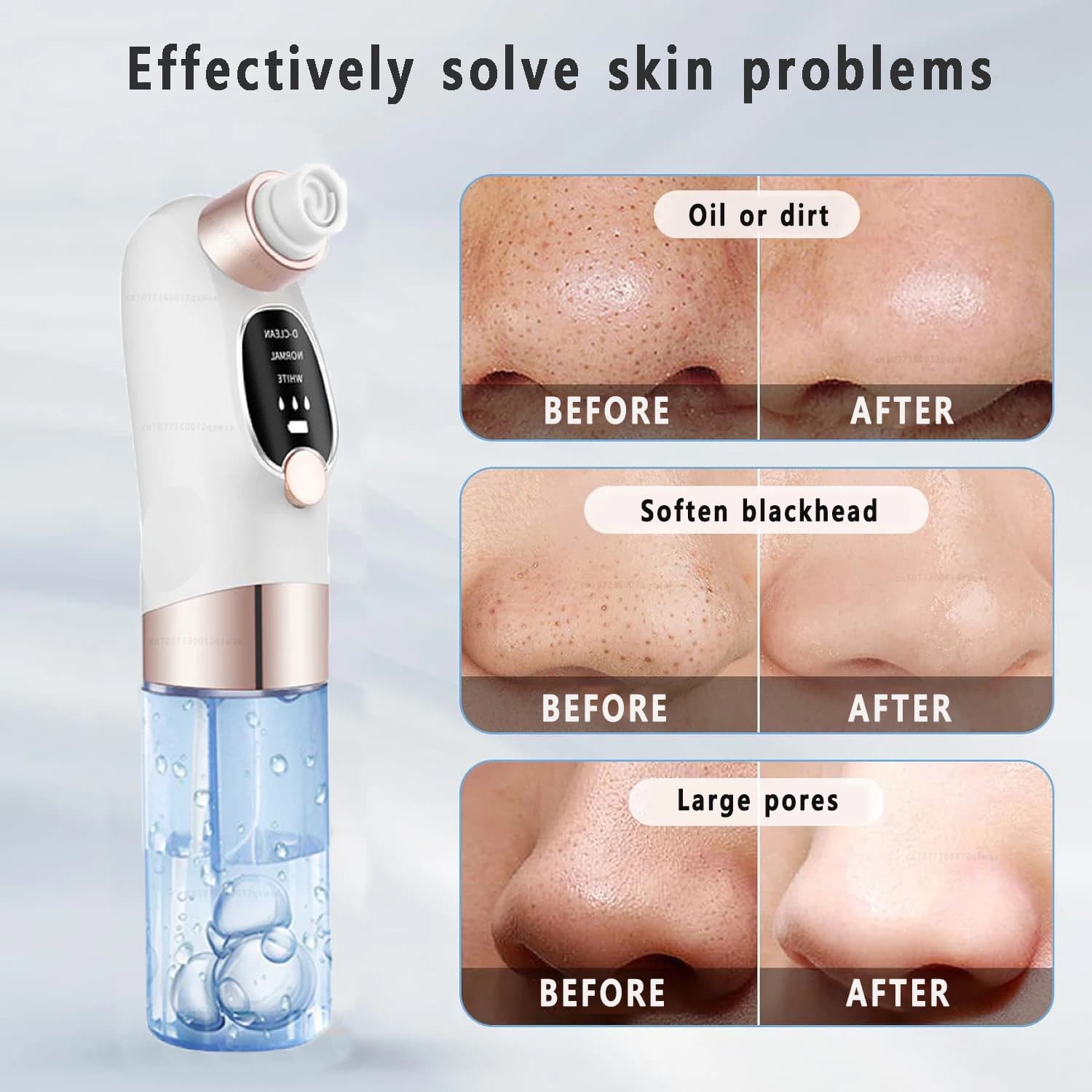 electric pore vacuum blackhead remover — image 5