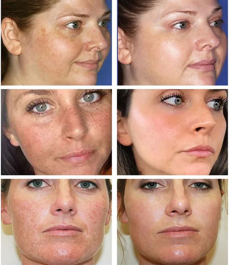 spot removing brightening cream jar — image 2
