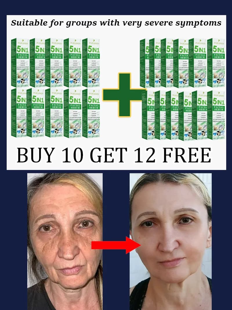 cream for removing wrinkles — image 4