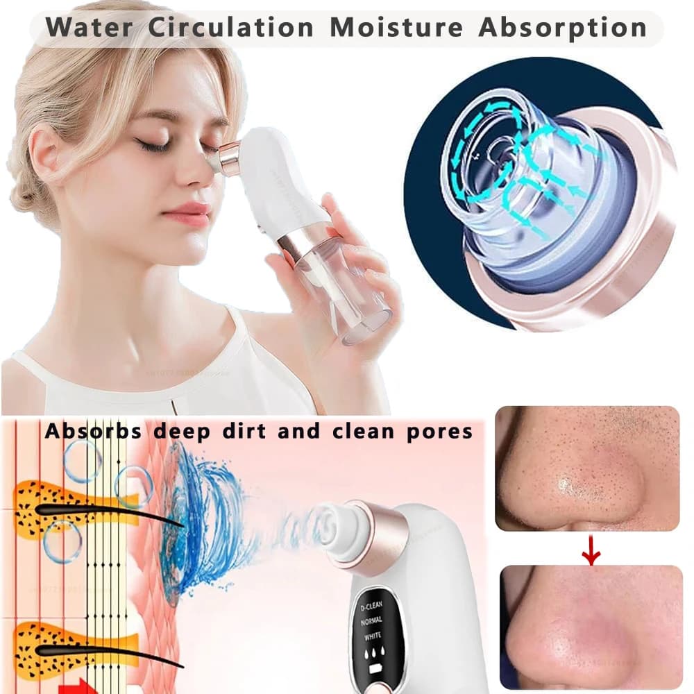 electric pore vacuum blackhead remover — image 3