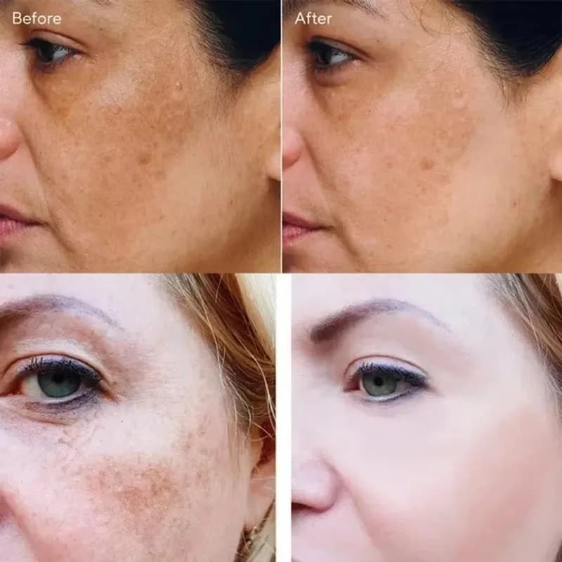 spot-removing brightening cream tube — image 4