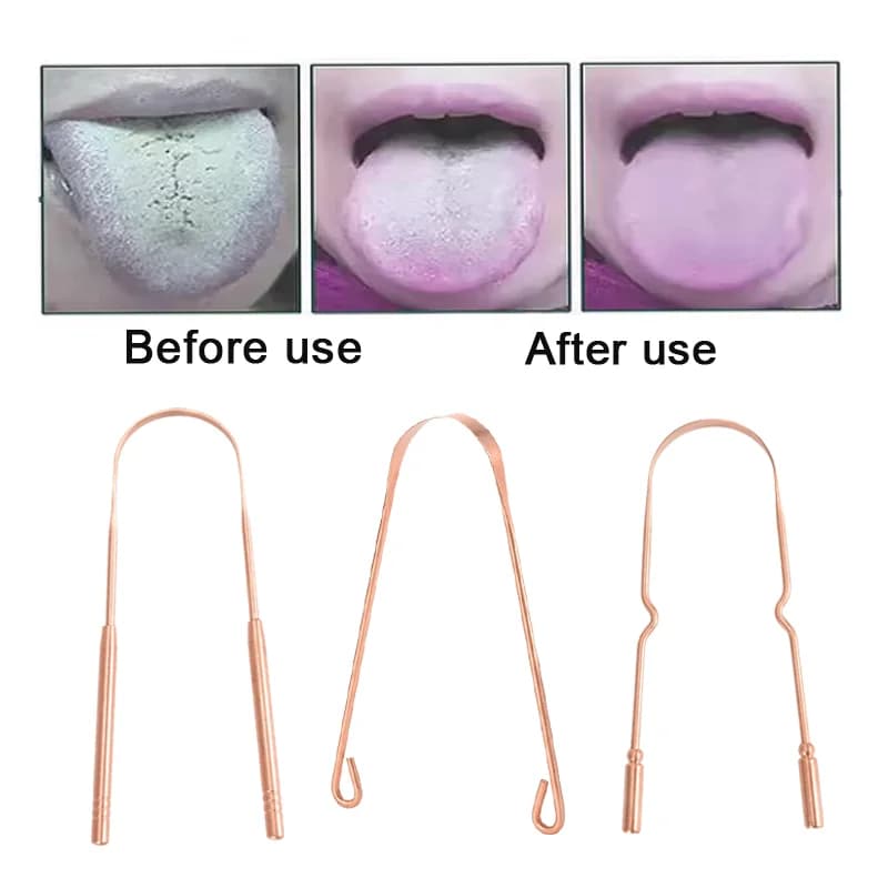 Pure copper tongue scraper with metal storage box — image 5