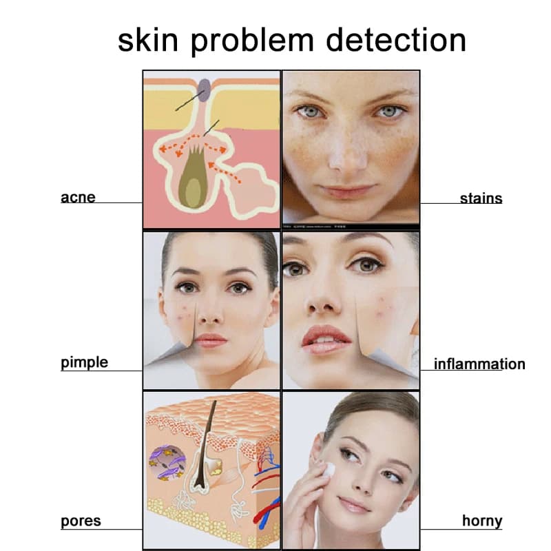 digital scalp detector with 50‑200× magnification — image 5
