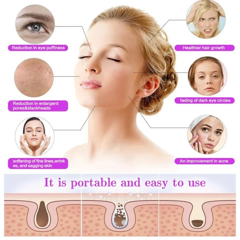 handheld high-frequency and microcurrent facial device — image 4