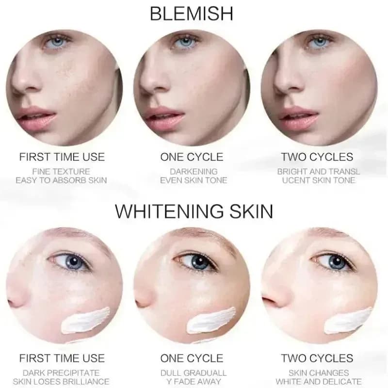 whitening cream with niacinamide for dark spots — image 6