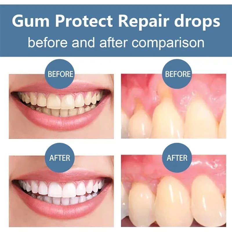 Bottle of gum recession relief serum — image 5