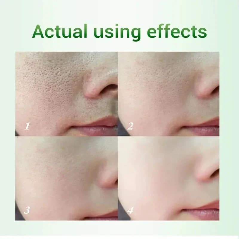 salicylic acid pore refining cream tube — image 2