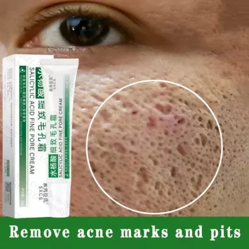 Pore Shrinking Cream for Large Pores & Blackheads