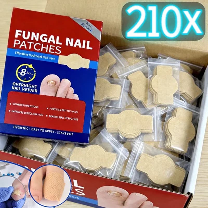 Nail Repair Patches – 21/210 pcs