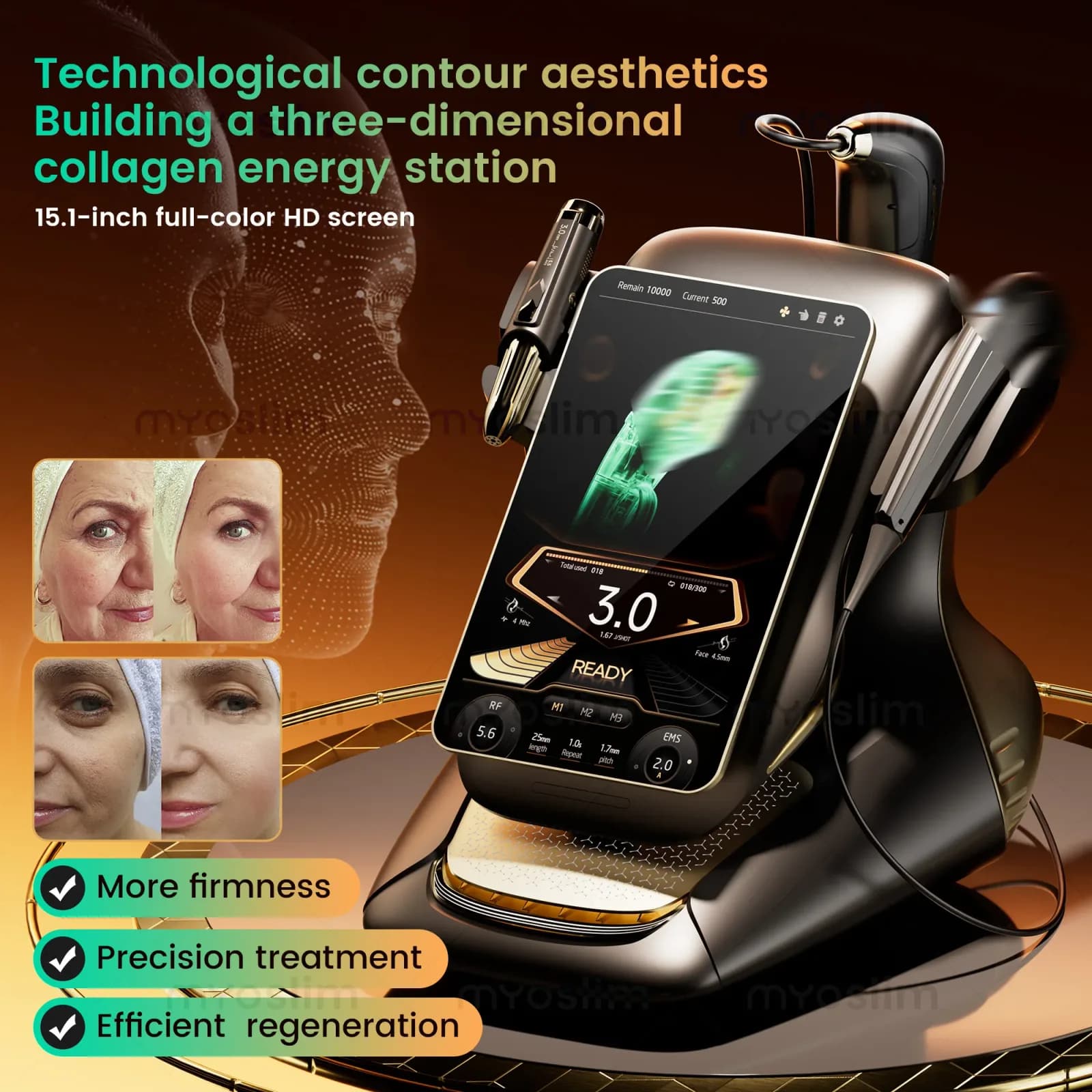 FUNMENTO 25D HIFU Facial Lifting Device