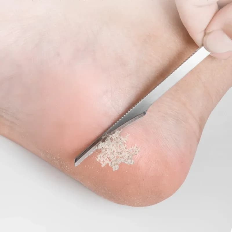 Portable Stainless Steel Foot Scraper for Pedicure